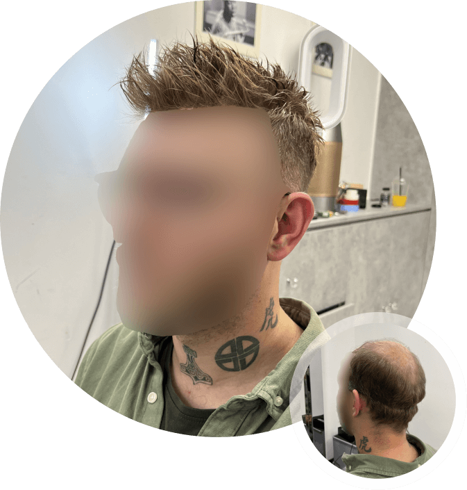 Men's Wig Before & After Look