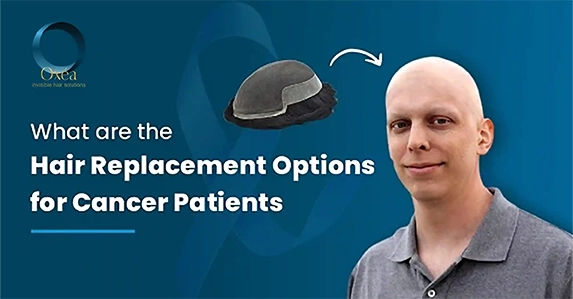 CANCER PATIENTS hair replacement