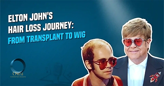 Elton-john