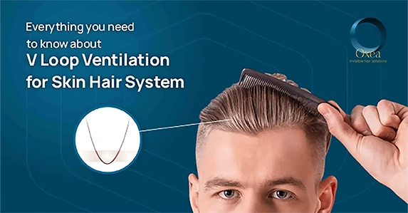 The Complete guide on V-loop ventilation for the skin hair system